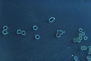 800px-Salmonella_enterica_serovar_typhimurium_01