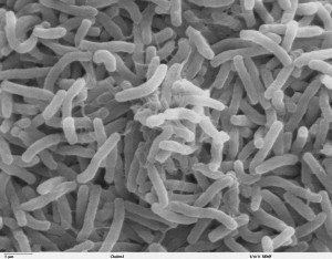 Cholera_bacteria_SEM