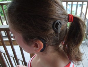 Cochlear_implant2