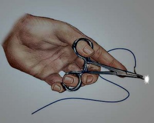 suture